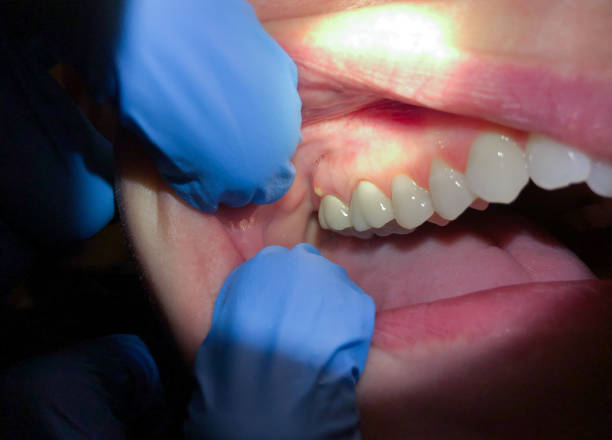 Best Emergency Denture Repair in Parker, AZ