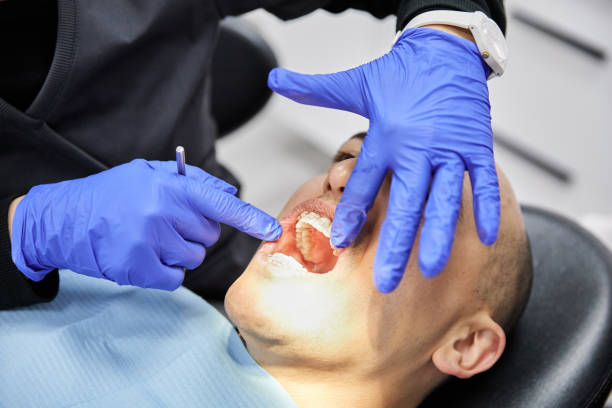 Best Emergency Wisdom Teeth Removal in Parker, AZ